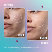 Load image into Gallery viewer, SELFLESS BY HYRAM SALICYLIC ACID AND SEA KELP PORE CLEARING AND OIL CONTROL SERUM 40ML