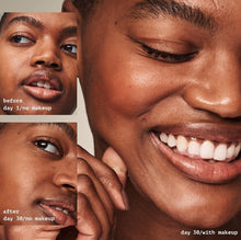 Load image into Gallery viewer, Elf acne fighting primer